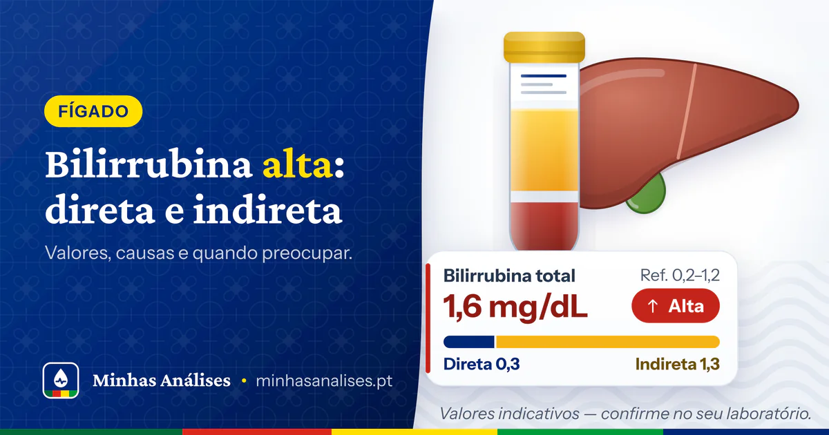 Tubo com soro amarelo-âmbar diante de um fígado e bilirrubina total a 1,6 mg/dL, alta, dividida em direta 0,3 e indireta 1,3