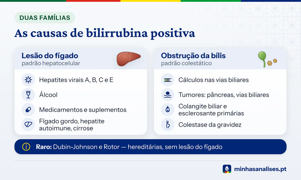 Duas famílias de causas de bilirrubina na urina: lesão do fígado, como hepatites e álcool, e obstrução da bílis por cálculos