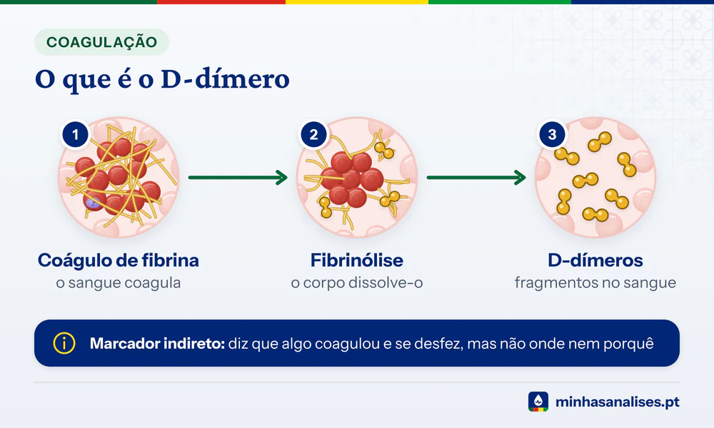 Três etapas do D-dímero: coágulo de fibrina com glóbulos vermelhos, dissolução por fibrinólise e fragmentos soltos no sangue