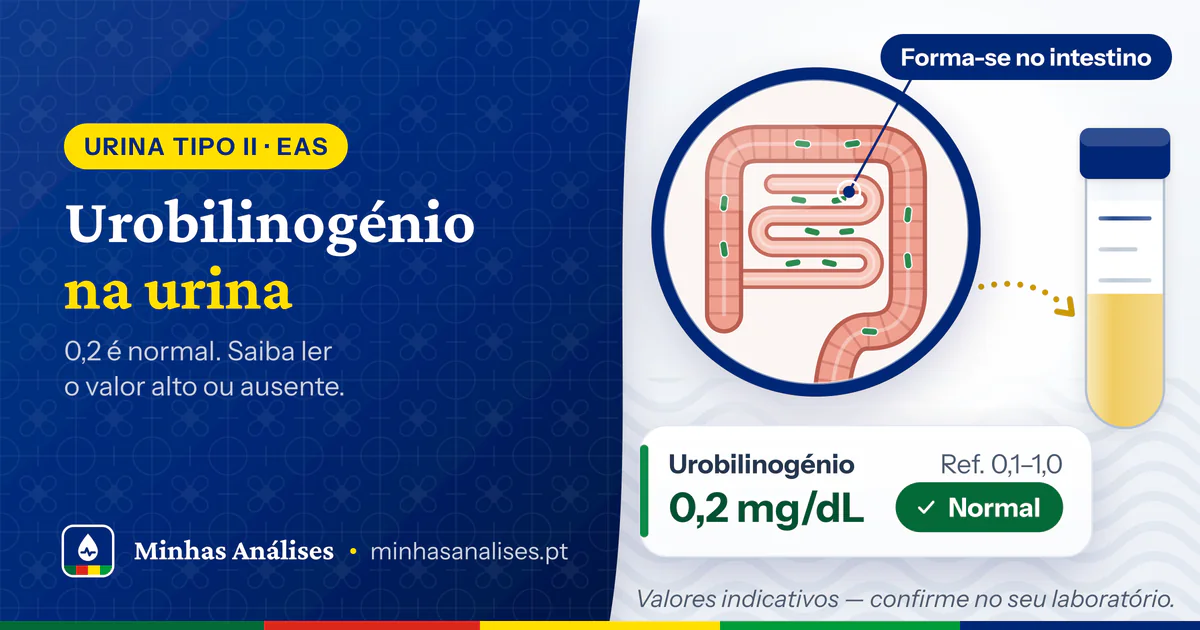 Intestinos com bactérias onde se forma o urobilinogénio, tubo de urina e resultado de 0,2 mg/dL assinalado como normal